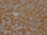 Complement C3 Antibody in Immunohistochemistry (Paraffin) (IHC (P))