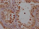 CYP17A1 Antibody in Immunohistochemistry (Paraffin) (IHC (P))