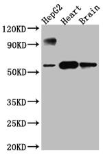 CYP17A1 Antibody in Western Blot (WB)