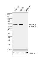 ACVRL1 Antibody