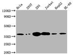 Thymidylate Synthase Antibody in Western Blot (WB)