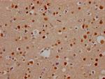 NOTCH1 Antibody in Immunohistochemistry (Paraffin) (IHC (P))