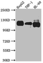 NOTCH1 Antibody in Western Blot (WB)