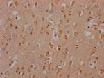 HTR2C Antibody in Immunohistochemistry (Paraffin) (IHC (P))