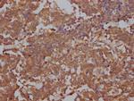 TOP2A Antibody in Immunohistochemistry (Paraffin) (IHC (P))