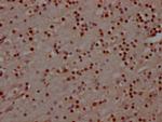 MAD2L2 Antibody in Immunohistochemistry (Paraffin) (IHC (P))