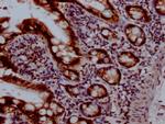 TOP1 Antibody in Immunohistochemistry (Paraffin) (IHC (P))