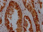 CD38 Antibody in Immunohistochemistry (Paraffin) (IHC (P))