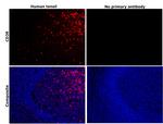 CD38 Antibody in Immunohistochemistry (Paraffin) (IHC (P))