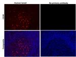 CD38 Antibody in Immunohistochemistry (Paraffin) (IHC (P))