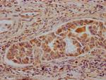 ALDH2 Antibody in Immunohistochemistry (Paraffin) (IHC (P))