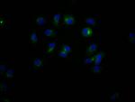 CD47 Antibody in Immunocytochemistry (ICC/IF)