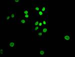 E2F1 Antibody in Immunocytochemistry (ICC/IF)