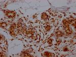 E2F1 Antibody in Immunohistochemistry (Paraffin) (IHC (P))