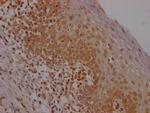 E2F1 Antibody in Immunohistochemistry (Paraffin) (IHC (P))