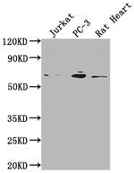 E2F1 Antibody in Western Blot (WB)