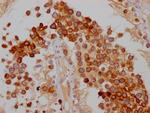 FDFT1 Antibody in Immunohistochemistry (Paraffin) (IHC (P))