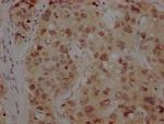 BMI-1 Antibody in Immunohistochemistry (Paraffin) (IHC (P))