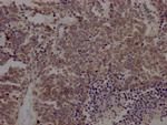 BMI-1 Antibody in Immunohistochemistry (Paraffin) (IHC (P))