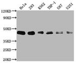 BMI-1 Antibody in Western Blot (WB)