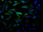 AKT1 Antibody in Immunocytochemistry (ICC/IF)