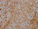 AKT1 Antibody in Immunohistochemistry (Paraffin) (IHC (P))