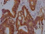 VDR Antibody in Immunohistochemistry (Paraffin) (IHC (P))