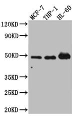 VDR Antibody in Western Blot (WB)