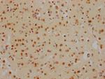 HDAC2 Antibody in Immunohistochemistry (Paraffin) (IHC (P))