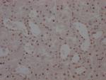 WT1 Antibody in Immunohistochemistry (Paraffin) (IHC (P))