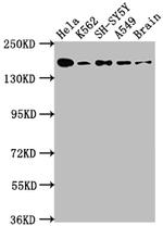 Protein APC Antibody in Western Blot (WB)