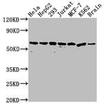 HSP60 Antibody in Western Blot (WB)