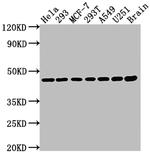 MEK1 Antibody in Western Blot (WB)