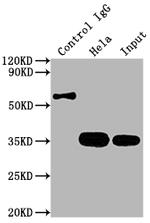 CDK4 Antibody in Immunoprecipitation (IP)