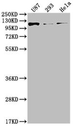 FGFR3 Antibody in Western Blot (WB)