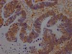 GRB2 Antibody in Immunohistochemistry (Paraffin) (IHC (P))