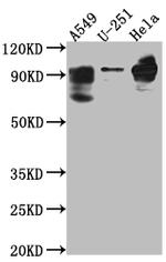 PDE4D Antibody in Western Blot (WB)