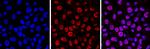 5-Methylcytosine Antibody in Immunocytochemistry (ICC/IF)