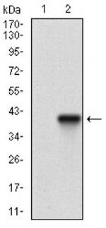 Tartrate Resistant Acid Phosphatase Antibody in Western Blot (WB)