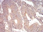 alpha Adducin Antibody in Immunohistochemistry (Paraffin) (IHC (P))