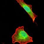 AIM2 Antibody in Immunocytochemistry (ICC/IF)