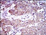 CD166 Antibody in Immunohistochemistry (Paraffin) (IHC (P))