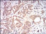 beta-2 Microglobulin Antibody in Immunohistochemistry (Paraffin) (IHC (P))