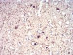 Calretinin Antibody in Immunohistochemistry (Paraffin) (IHC (P))