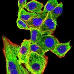 Langerin Antibody in Immunocytochemistry (ICC/IF)