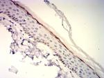 Langerin Antibody in Immunohistochemistry (Paraffin) (IHC (P))