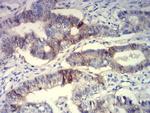 BCAM Antibody in Immunohistochemistry (Paraffin) (IHC (P))