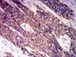 CD99 Antibody in Immunohistochemistry (Paraffin) (IHC (P))