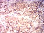 CD99 Antibody in Immunohistochemistry (Paraffin) (IHC (P))