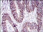 CDH17 Antibody in Immunohistochemistry (Paraffin) (IHC (P))